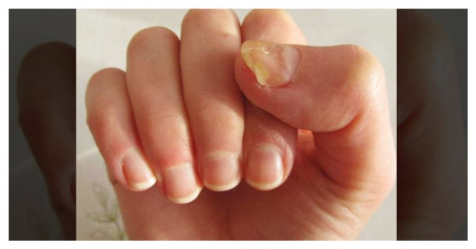 nails give information about our health