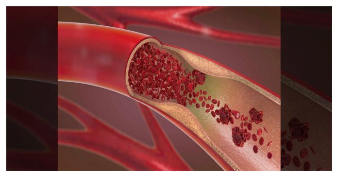 weak nerves of the body