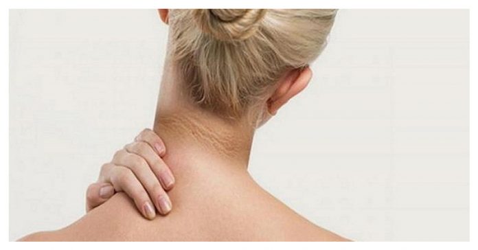 Black neck