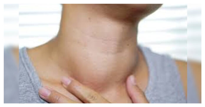 Thyroid symptoms